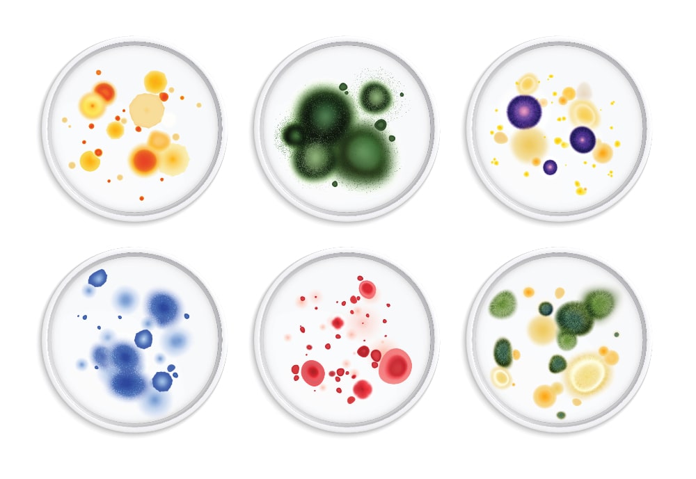photo of mold colors